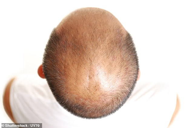 covid hair loss